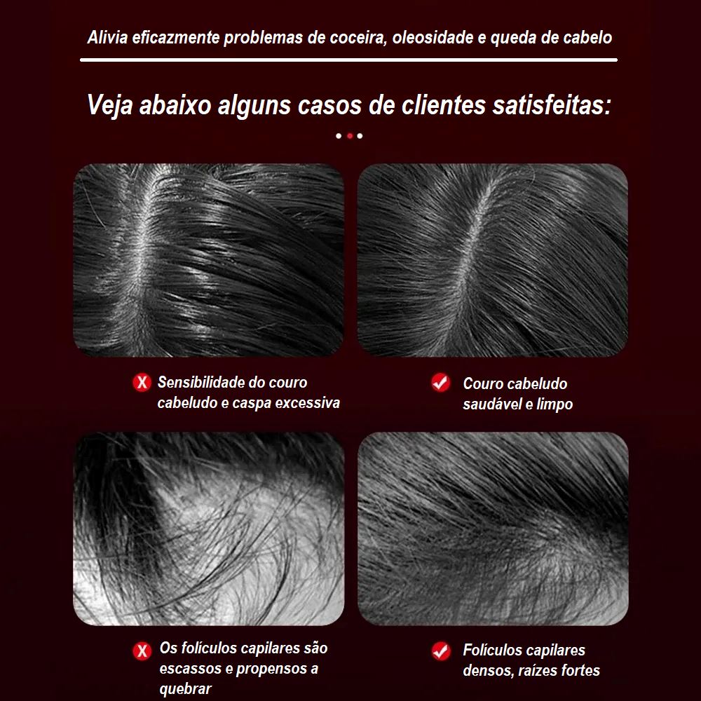 Escova Massageadora de Cabelo